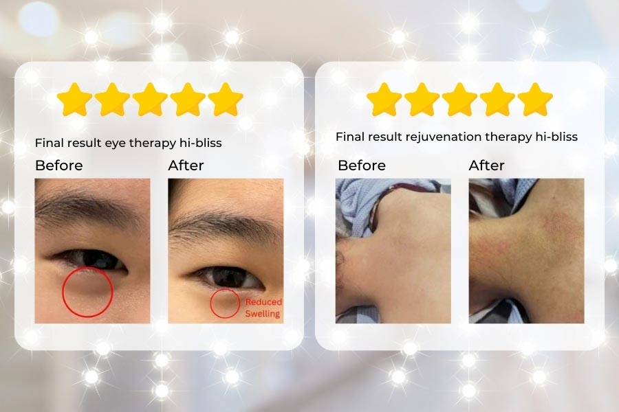 Testimony wellness hibliss