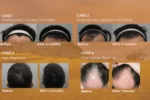 exosome hair testimonial