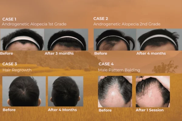 exosome hair testimonial